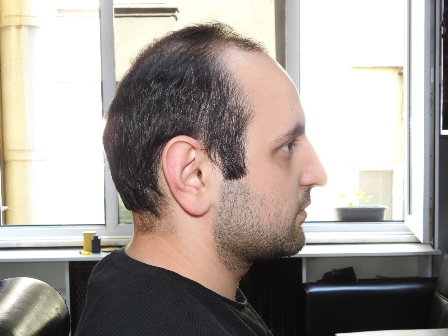 Avant-Garde Hair