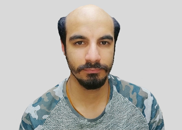 Avant-Garde Hair
