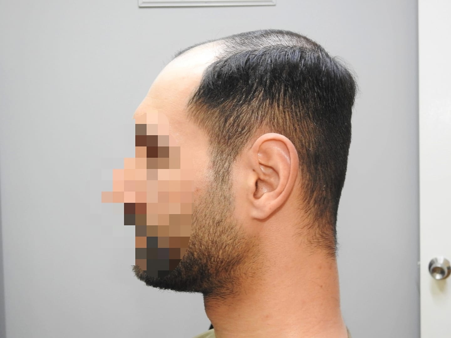 Avant-Garde Hair